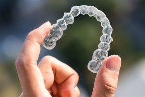 Orthodontie Invisible : le traitement par gouttières